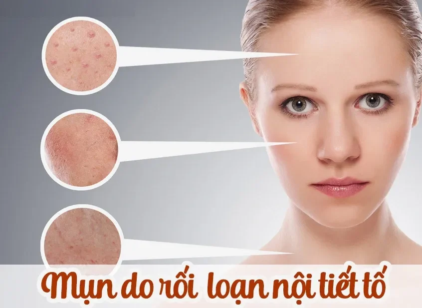 Bài tập Thiền và Thở - "Lắng nghe" cơ thể, giảm stress từ bên trong