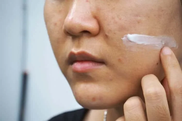 Lợi ích khi sử dụng thuốc cân bằng nội tiết tố nữ