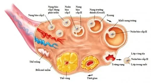 Suy tuyến sinh dục nguyên phát (do buồng trứng)