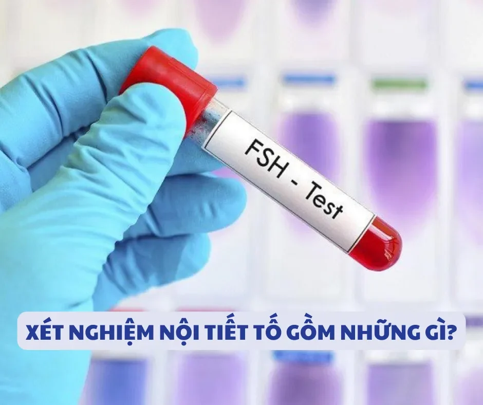 Xét nghiệm nội tiết tố nữ là gì
